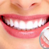 Эволюция способов лечения каналов зубов