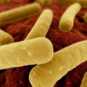 Инфекция Clostridium difficile у взрослых Инфекция Clostridium difficile у взрослых