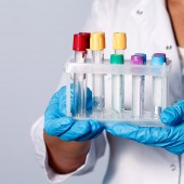 Как правильно сдать анализы на гепатит C?