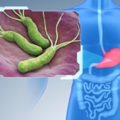 Частые вопросы по Хеликобактер (Н.Pylori)