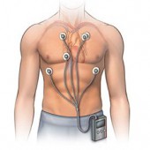Холтер ЭКГ и длительный мониторинг ритма: что выявляют Холтер ЭКГ и длительный мониторинг ритма: что выявляют