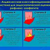 Эндоскопические критерии ГЭРБ